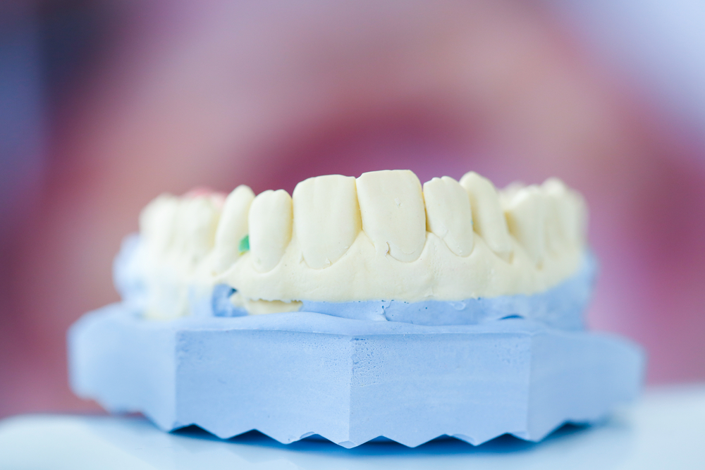 Dental Plaster Mold
