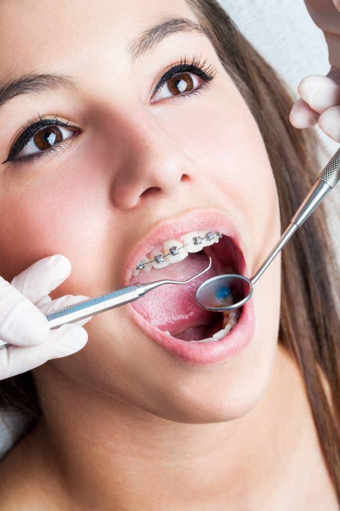 Dental Care