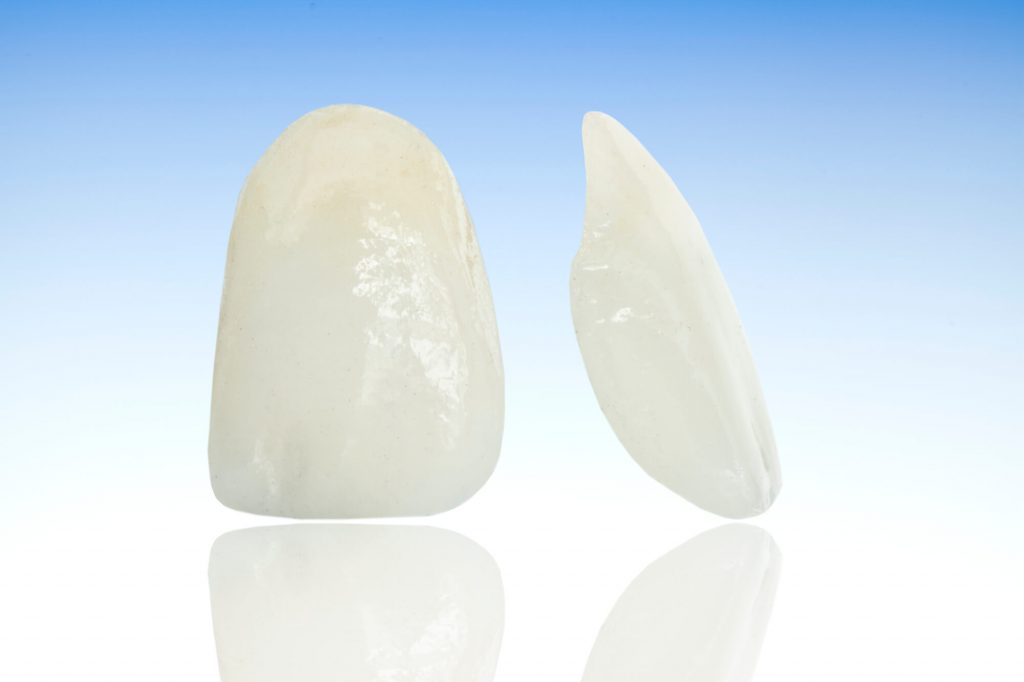 Interested in Getting Veneers Phillips?