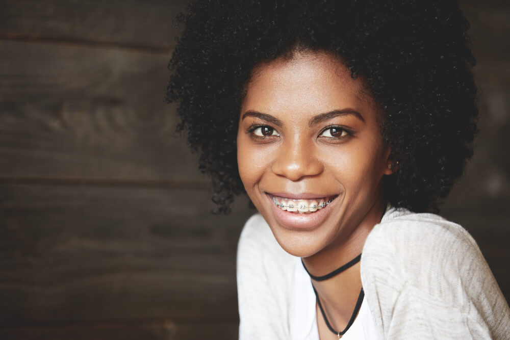 What are Teeth Braces Medford?