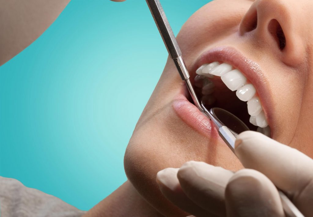 where is the best crowns philips?