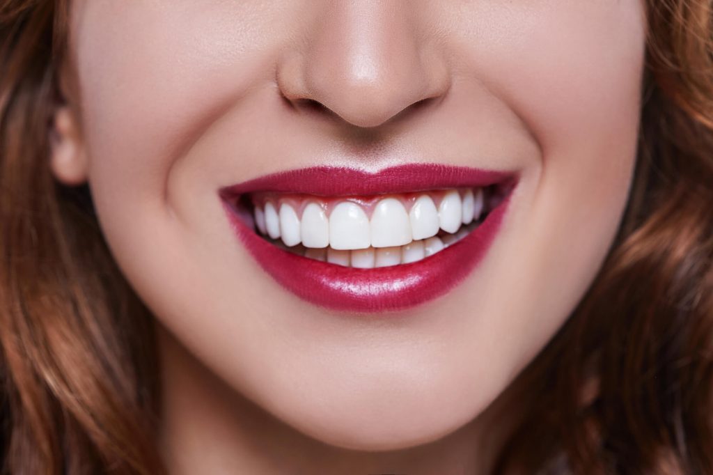 What is Teeth Straightening Ladysmith?
