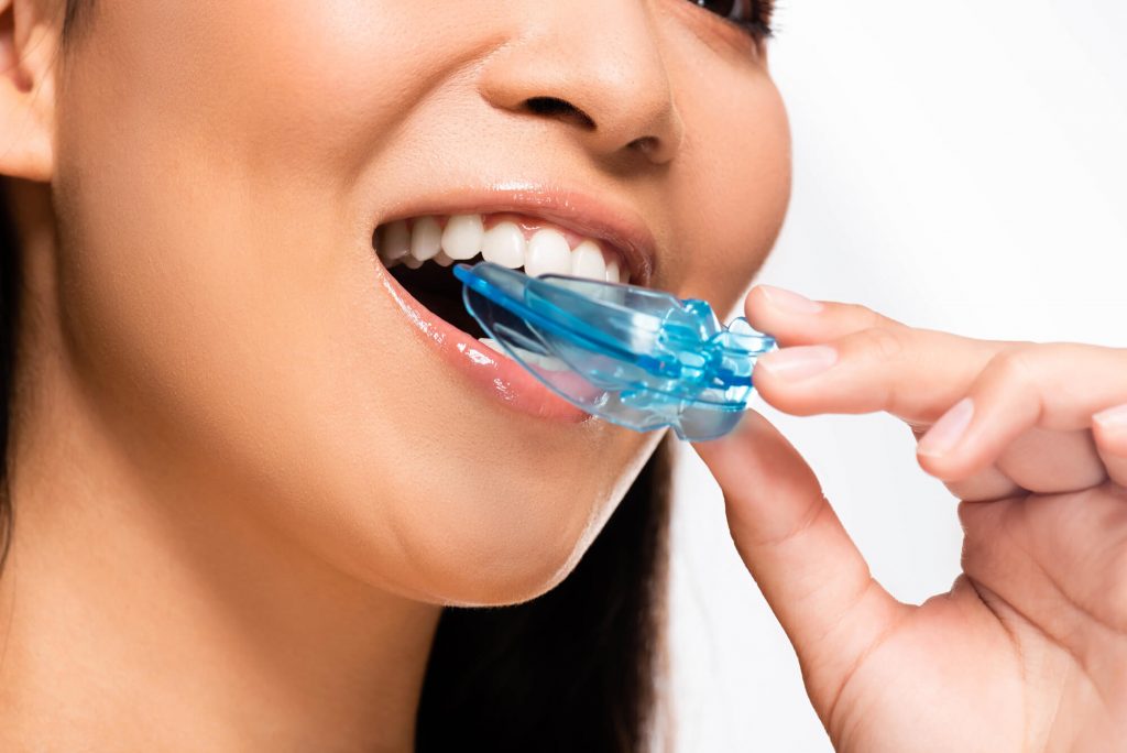 Where can I get Sports Mouth Guard Ladysmith WI?