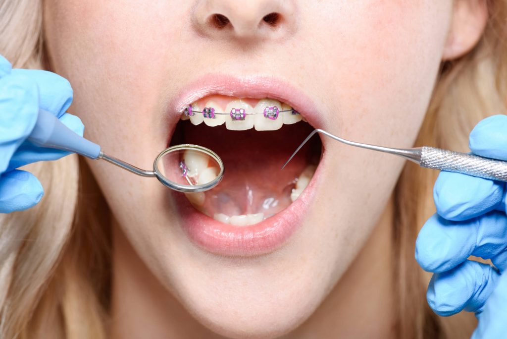 where can i get orthodontic treatments in park falls?