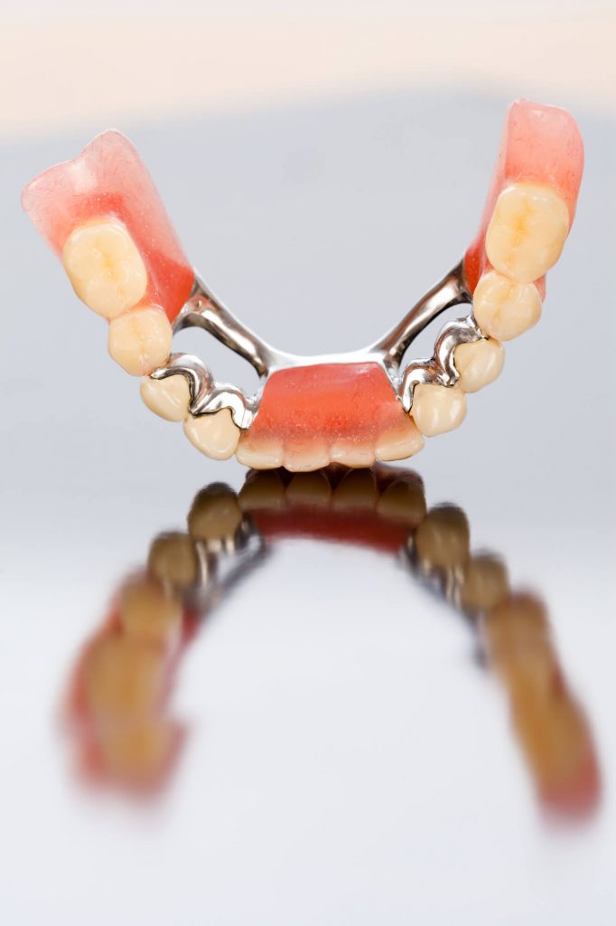 an example of dental bridges in Phillips