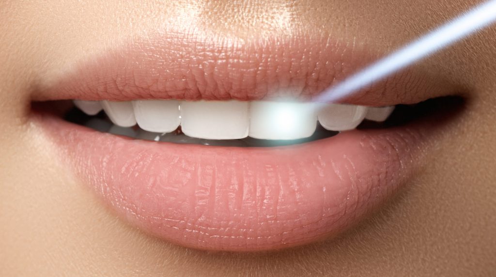 consider laser dentistry in Park Falls