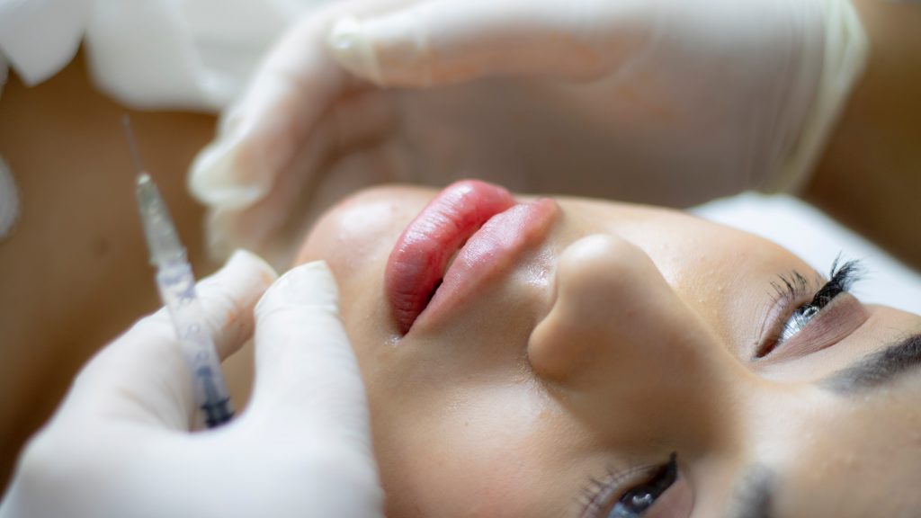 a woman gets JUVEDERM® in Park Falls