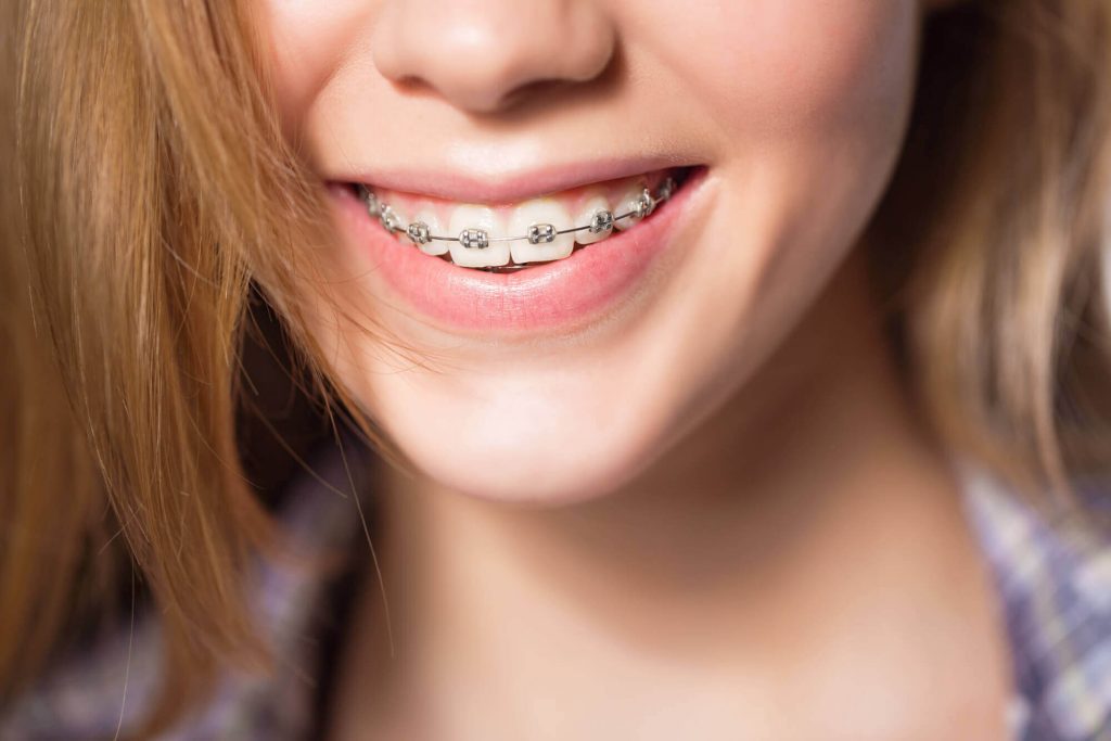 teenager with Teeth Braces in Medford
