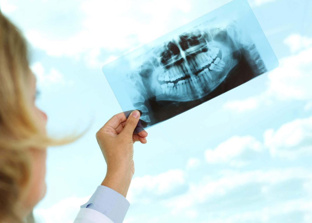 a dentist discusses Panoramic X-rays in Phillips