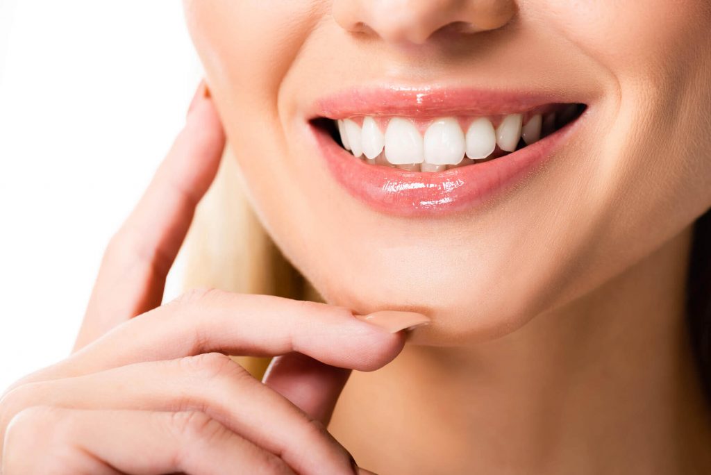 A woman shows off her veneers in Phillips