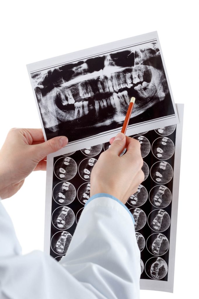 periodontal in medford x-ray