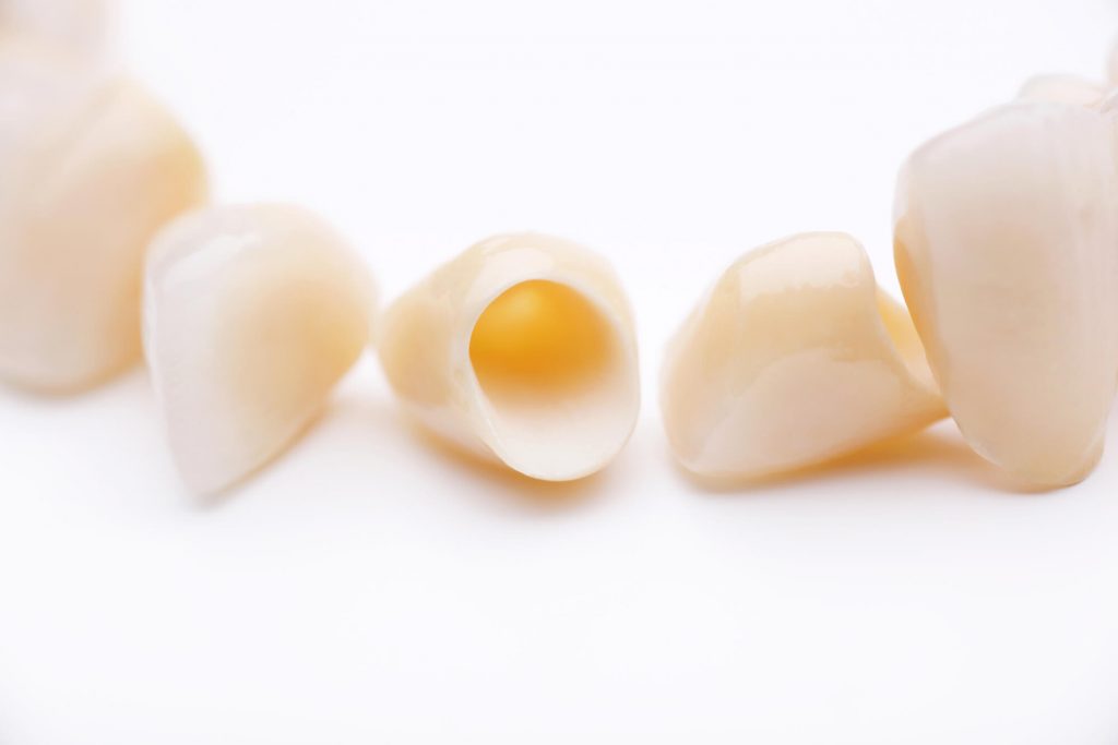 crowns in phillips