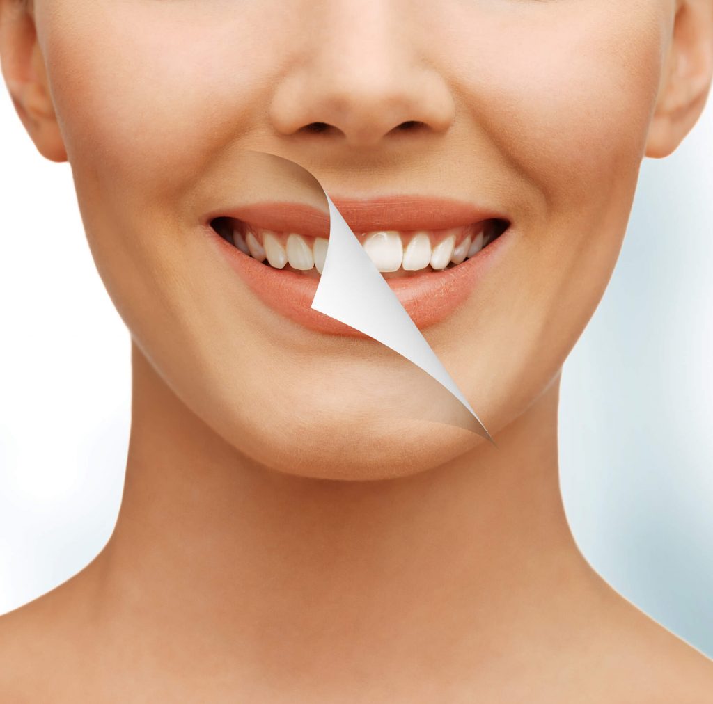 smiling woman after teeth whitening medford