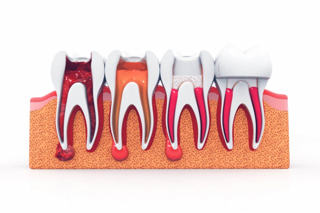 Illustration of Medford endodontics 