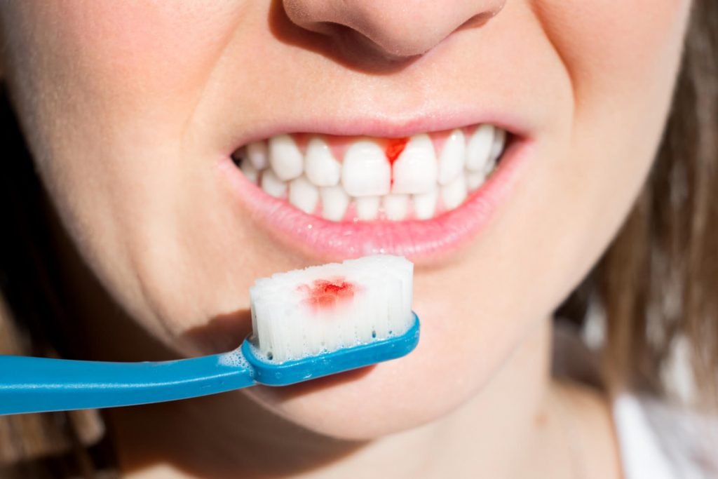 before and after periodontal care in Medford 