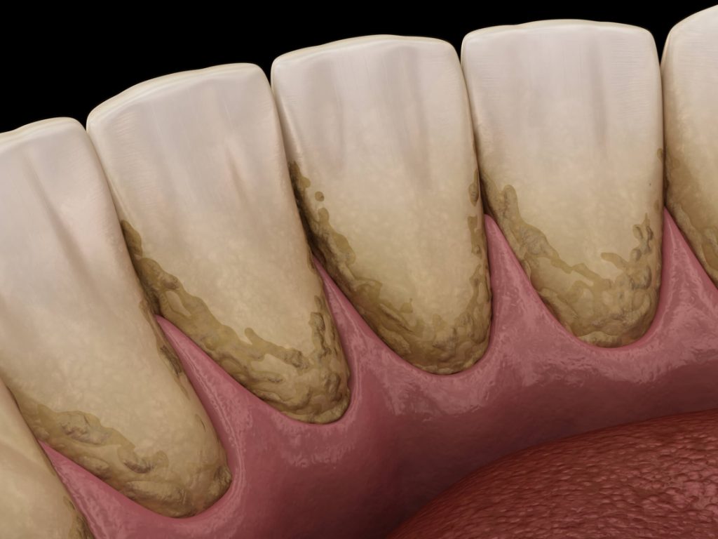 illustration of children's dental in medford