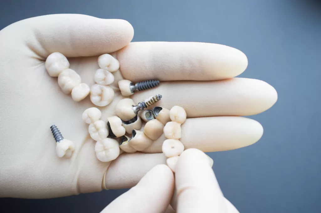 dental implants ladysmith in gloved hands